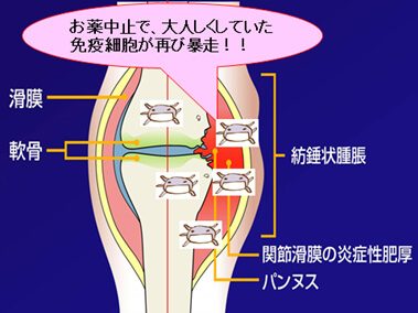 再発
